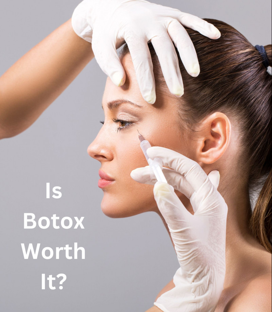 is botox worth it